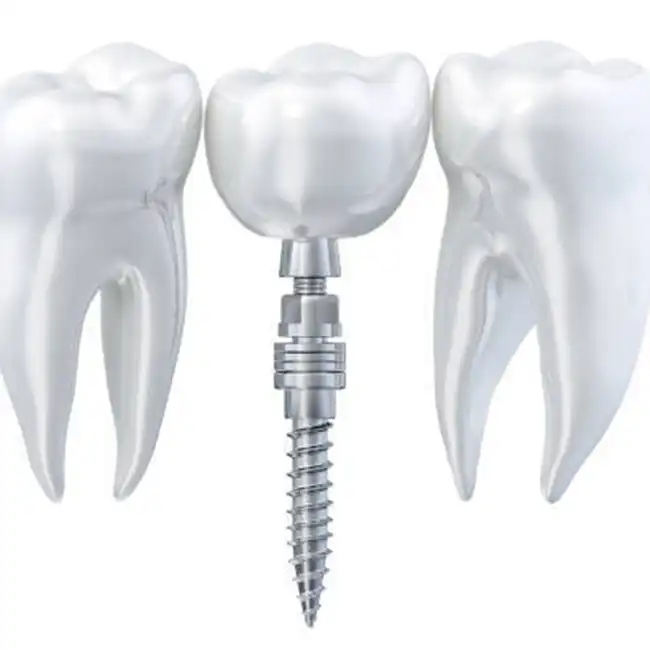 Titanium Rod Medical benefits: biocompatibility and corrosion resistance